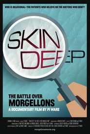 Skin Deep: The Battle Over Morgellons