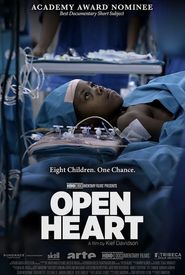 Open Heart