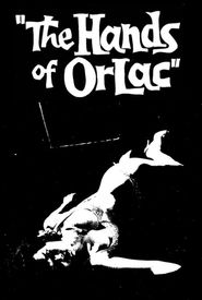 The Hands of Orlac