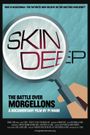 Skin Deep: The Battle Over Morgellons